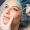 botox